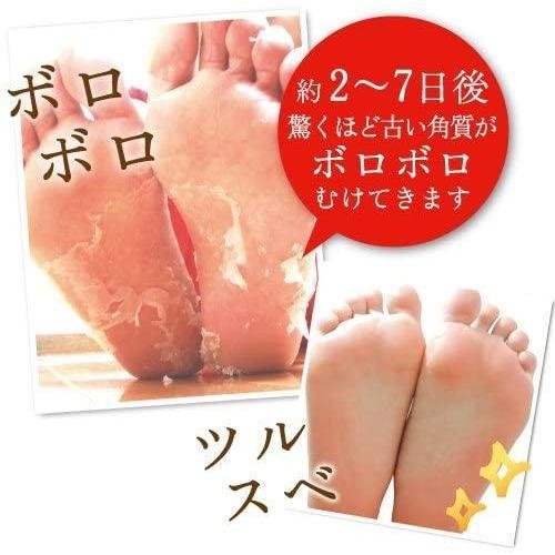 Liberta Baby Foot Exfoliation Foot Peel 30 Minutes Treatment - Size S